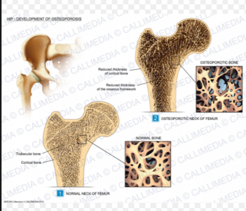 Foto Osteoporosis And Rheumatology Center de Clínicas Médicas en Tampa FL - Galería de ListasLocales.com