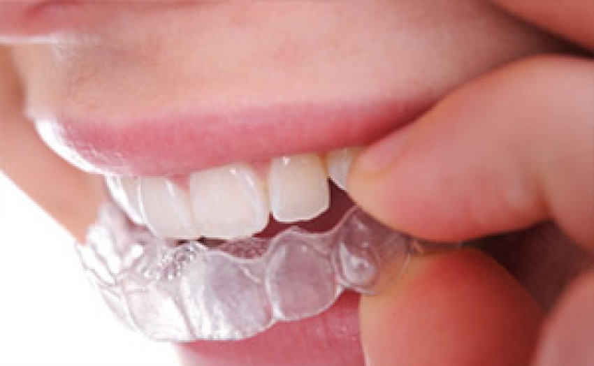 Foto Calm Dental de Clínicas Dentales en Los Angeles CA - Galería de ListasLocales.com
