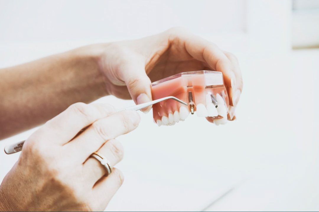 Foto Affordable Dentures and Implants Tampa FL de Dentistas en Tampa FL - Galería de ListasLocales.com